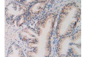 IHC-P analysis of Human Prostate Gland Tissue, with DAB staining. (CD46 antibody  (AA 147-285))