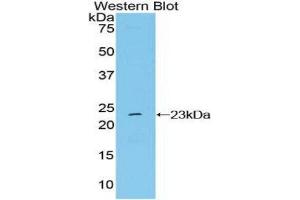 Western Blotting (WB) image for anti-Non Metastatic Cells 6, Protein Expressed In (AA 1-184) antibody (ABIN1860010) (Non Metastatic Cells 6, Protein Expressed In (AA 1-184) antibody)