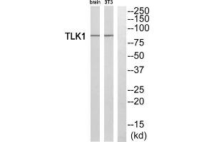 Western blot analysis of extracts from rat brain cells and NIH/3T3 cells, using TLK1 antibody. (TLK1 antibody  (Internal Region))