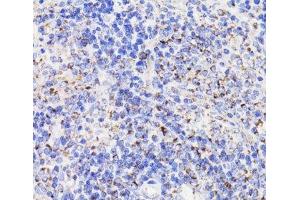 Immunohistochemistry of paraffin-embedded Rat spleen using PDCD10 Polyclonal Antibody at dilution of 1:100 (40x lens). (PDCD10 antibody)