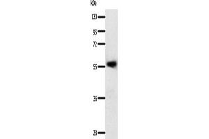 Western Blotting (WB) image for anti-Solute Carrier Family 22 (Organic Cation Transporter), Member 17 (SLC22A17) antibody (ABIN2432278) (SLC22A17 antibody)