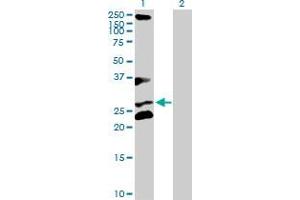 Lane 1: RCHY1 transfected lysate ( 29. (RCHY1 293T Cell Transient Overexpression Lysate(Denatured))