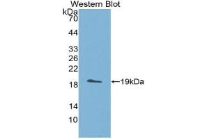 Western blot analysis of the recombinant protein. (ADAMTS5 antibody  (AA 485-622))