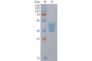 Mouse Protein, hFc Tag on SDS-PAGE under reducing condition. (CCR2 Protein (AA 1-55) (Fc Tag))