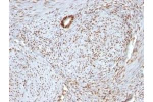 Immunohistochemistry (Formalin-fixed Paraffin-embedded Sections) (IHC (fp)) image for anti-Nucleolin (NCL) antibody (ABIN3025717)