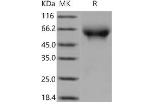 Western Blotting (WB) image for Poliovirus Receptor (PVR) (Active) protein (His tag) (ABIN7321243) (Poliovirus Receptor Protein (PVR) (His tag))