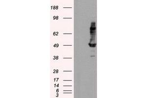 Image no. 2 for anti-Intraflagellar Transport 57 Homolog (IFT57) antibody (ABIN1498809) (IFT57 antibody)