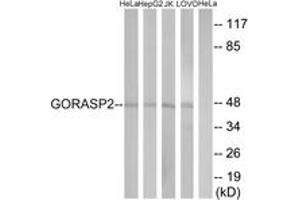 Western Blotting (WB) image for anti-Golgi Reassembly Stacking Protein 2, 55kDa (GORASP2) (AA 181-230) antibody (ABIN2890347) (GORASP2 antibody  (AA 181-230))