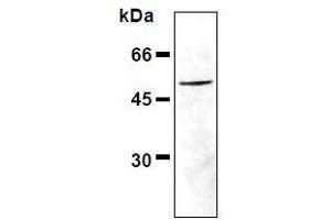 Western Blotting (WB) image for anti-Vimentin (VIM) (pSer33) antibody (ABIN1449152) (Vimentin antibody  (pSer33))