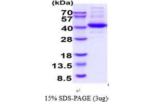SDS-PAGE (SDS) image for Aldolase C, Fructose-Bisphosphate (ALDOC) (AA 1-364) protein (ABIN5854638) (ALDOC Protein (AA 1-364))