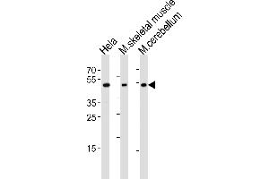 Western blot analysis of lysates from Hela cell line, mouse skeletal muscle and mouse cerebellum tissue lysate(from left to right), using Mouse Hoxc10 Antibody at 1:1000 at each lane. (HOXC10 antibody  (C-Term))