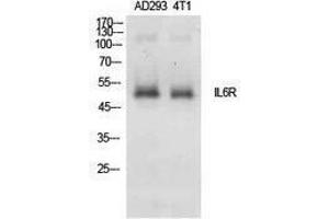 Western Blotting (WB) image for anti-Interleukin 6 Receptor, alpha (IL6RA) (Internal Region) antibody (ABIN3181401) (IL6RA antibody  (Internal Region))