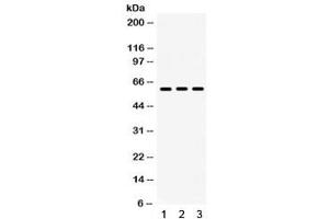 Western blot testing of mouse 1) testis, 2) thymus and 3) NIH3T3 lysate with Lumican antibody. (LUM antibody  (AA 68-338))