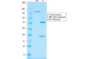 SDS-PAGE (SDS) image for anti-Epithelial Cell Adhesion Molecule (EPCAM) antibody (ABIN6939981)