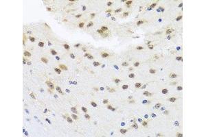 Immunohistochemistry of paraffin-embedded Mouse brain using HDAC4 Polyclonal Antibody at dilution of 1:100 (40x lens). (HDAC4 antibody)