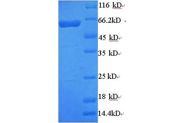 Arylsulfatase B Protein (ARSB) (AA 37-533) (His-SUMO Tag)