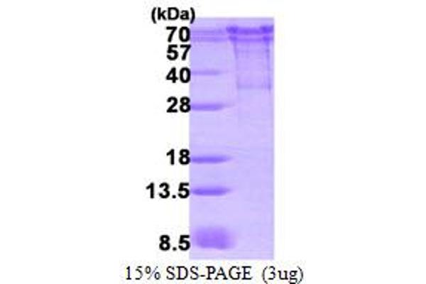 Chromogranin A Protein (CHGA) (AA 19-457) (His tag)