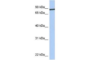 WB Suggested Anti-JPH1 Antibody Titration:  0. (Junctophilin 1 antibody  (C-Term))