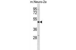 Western Blotting (WB) image for anti-Doublecortin Domain Containing 2 (DCDC2) antibody (ABIN3000420) (DCDC2 antibody)