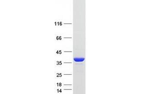 DNAJB13 Protein (Myc-DYKDDDDK Tag)