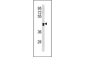 LRRC2 Antibody (N-term) (ABIN1881510 and ABIN2843288) western blot analysis in NCI- cell line lysates (35 μg/lane). (LRRC2 antibody  (N-Term))