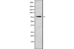 Western blot analysis GOLM1 using Jurkat whole cell lysates (GOLM1 antibody  (C-Term))