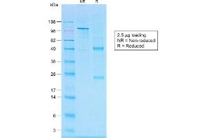 SDS-PAGE Analysis of Purified CD20 Rabbit Recombinant Monoclonal Antibody (IGEL/1497R). (Recombinant CD20 antibody)