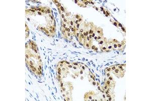 Immunohistochemistry of paraffin-embedded human prostate using RAD23B antibody. (RAD23B antibody  (AA 50-150))