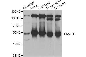 Western blot analysis of extracts of various cell lines, using FSCN1 antibody (ABIN6292926) at 1:1000 dilution. (Fascin antibody)