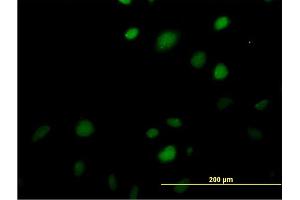 Immunofluorescence of monoclonal antibody to MAZ on HeLa cell. (MAZ antibody  (AA 332-440))