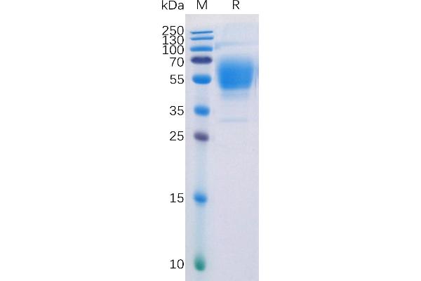 CNR1 Protein (AA 1-116) (Fc Tag)