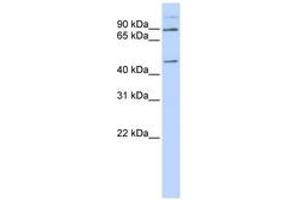 Image no. 1 for anti-Leber Congenital Amaurosis 5-Like (LCA5L) (C-Term) antibody (ABIN6740943) (LCA5L antibody  (C-Term))