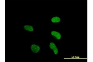 Immunofluorescence of purified MaxPab antibody to ATF6 on HeLa cell. (ATF6 antibody  (AA 1-202))