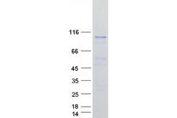 COPB1 Protein (Transcript Variant 1) (Myc-DYKDDDDK Tag)