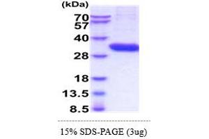 SDS-PAGE (SDS) image for Tryptase alpha/beta 1 (TPSAB1) (AA 31-275) protein (His tag) (ABIN5855023) (TPSAB1 Protein (AA 31-275) (His tag))