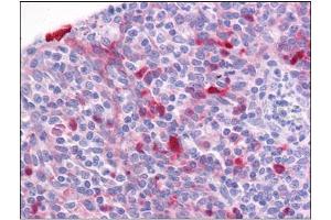 Human Tonsil: Formalin-Fixed, Paraffin-Embedded (FFPE) (Girdin antibody  (C-Term))