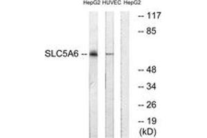 Western Blotting (WB) image for anti-Solute Carrier Family 5 (Iodide Transporter), Member 6 (SLC5A6) (AA 551-600) antibody (ABIN2890649) (SLC5A6 antibody  (AA 551-600))