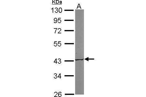 ACAT1 antibody  (N-Term)