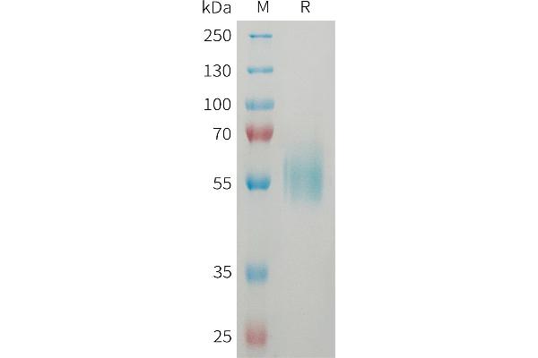 IL1RL1 Protein (AA 19-328) (His tag)