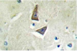 Immunohistochemical analysis using CD4 antibody in Paraffin-embedded human brain tissue. (CD4 antibody)