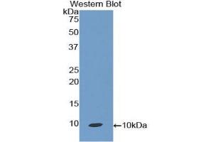 Western blot analysis of the recombinant protein. (CCL19 antibody  (AA 32-103))