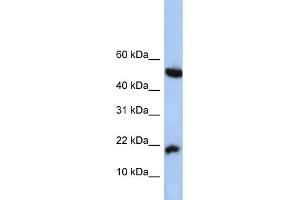 WB Suggested Anti-LOC285033 Antibody Titration: 0. (LOC285033 antibody  (N-Term))