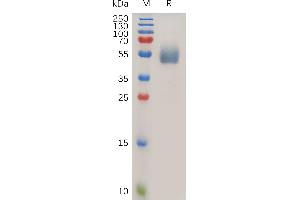 Human IL1R2 Protein, His Tag on SDS-PAGE under reducing condition. (IL1R2 Protein (AA 14-343) (His tag))