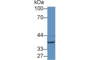 Western Blot; Sample: Mouse Liver lysate; Primary Ab: 1µg/ml Rabbit Anti-Rat NAT2 Antibody Second Ab: 0. (NAT2 antibody  (AA 20-280))