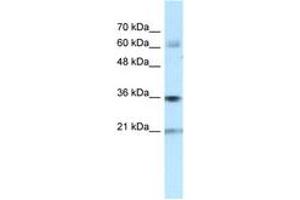 Image no. 1 for anti-Pim-1 Oncogene (PIM1) (N-Term) antibody (ABIN6741658) (PIM1 antibody  (N-Term))