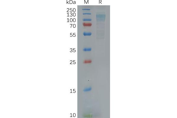 F4/80 Protein (AA 21-599) (His tag)