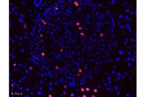 Image no. 1 for anti-Bromodeoxyuridine (BrdU) antibody (ABIN1100302) (BrdU antibody)