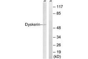 Western Blotting (WB) image for anti-Dyskeratosis Congenita 1, Dyskerin (DKC1) (AA 171-220) antibody (ABIN2889340) (DKC1 antibody  (AA 171-220))