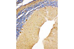 Immunohistochemistry (IHC) image for anti-Nucleoside diphosphate kinase B (NME2) (AA 137-152), (C-Term) antibody (ABIN3044198)