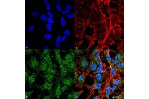 Immunocytochemistry/Immunofluorescence analysis using Rabbit Anti-UVRAG Polyclonal Antibody . (UVRAG antibody  (Biotin))